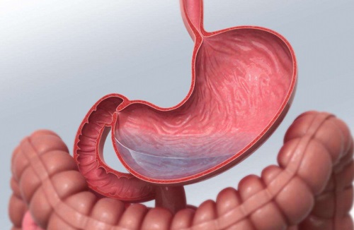 胃炎的症状有哪些 肠胃炎不能吃什么食物