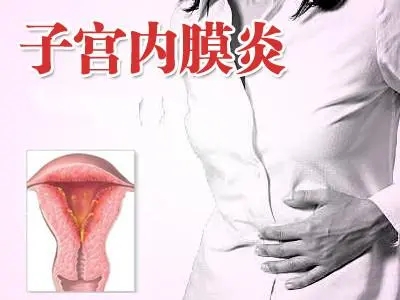 子宫内膜炎的症状是什么 子宫内膜炎可以热敷吗