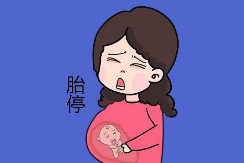 孕妈三个行为会引起胎停是什么 孕妈胎停会有哪些症状