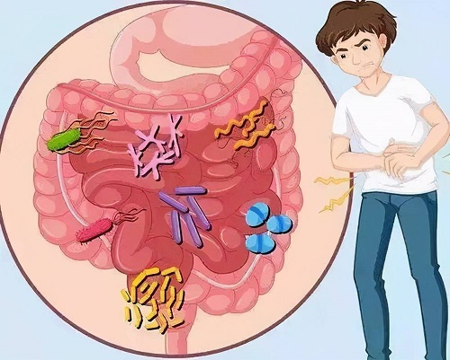 慢性结肠炎的症状是什么 慢性结肠炎癌变几率大吗