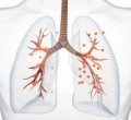 白肺病的症状是什么表现 白肺病会传染吗