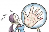 先天性梅毒的症状有哪些 怎么预防先天性梅毒