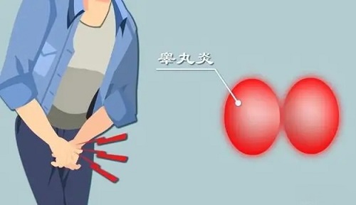 附睾炎会导致男性不育吗 附睾炎如何有效预防